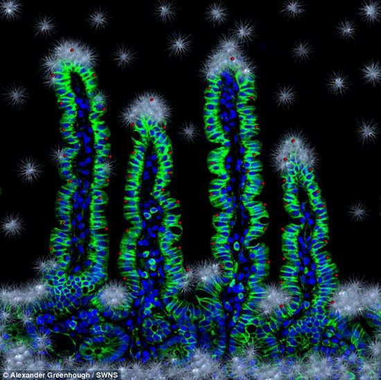 最新人体肠壁细胞显微图像犹如雪花圣诞树